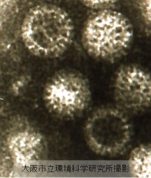 図1　ロタウイルスAの電子顕微鏡写真（大阪市立環境科学研究所撮影）