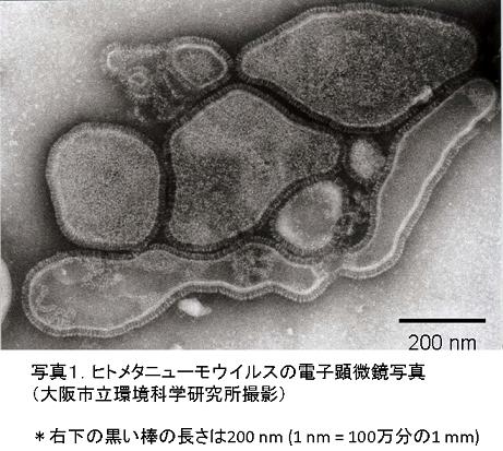 写真1.ヒトメタニューもウイルスの電子顕微鏡写真（大阪私立環境科学研究所撮影）
