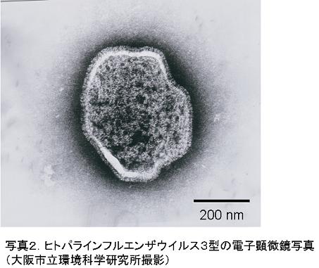 図2.ヒトパラインフルエンザウイルス3型の電子顕微鏡写真（大阪市立環境科学研究所）