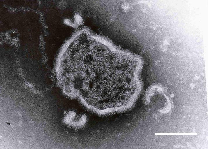図1　RSウイルスの電子顕微鏡写真（大阪市立環境科学研究所撮影）