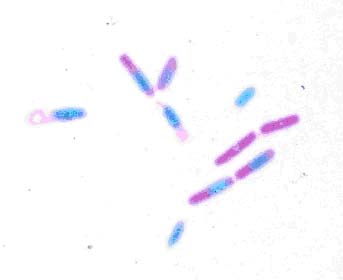 セレウス菌の顕微鏡写真（芽胞染色）