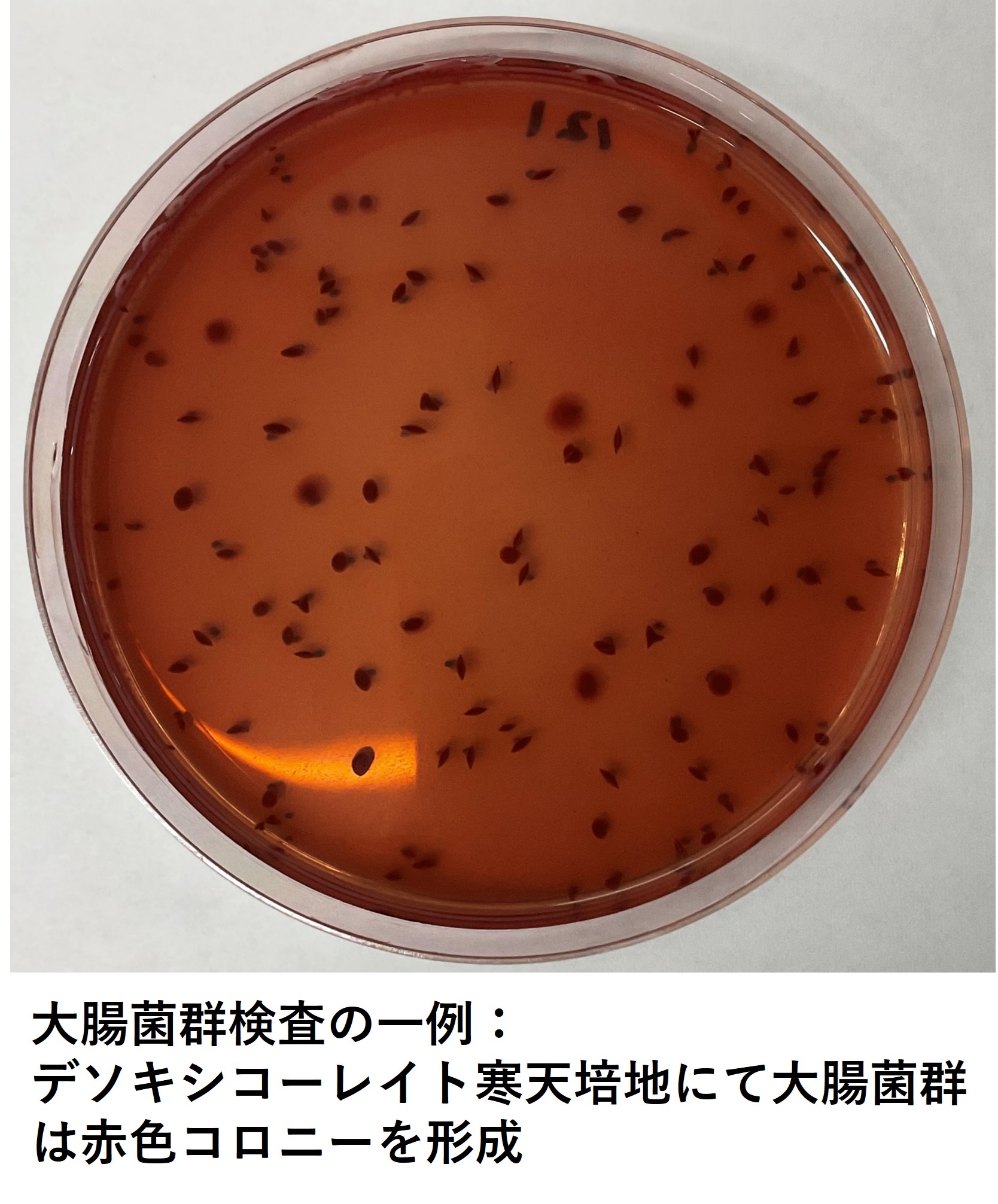 coliformpict.jpg