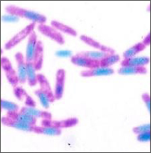 図　セレウス菌の芽胞染色像